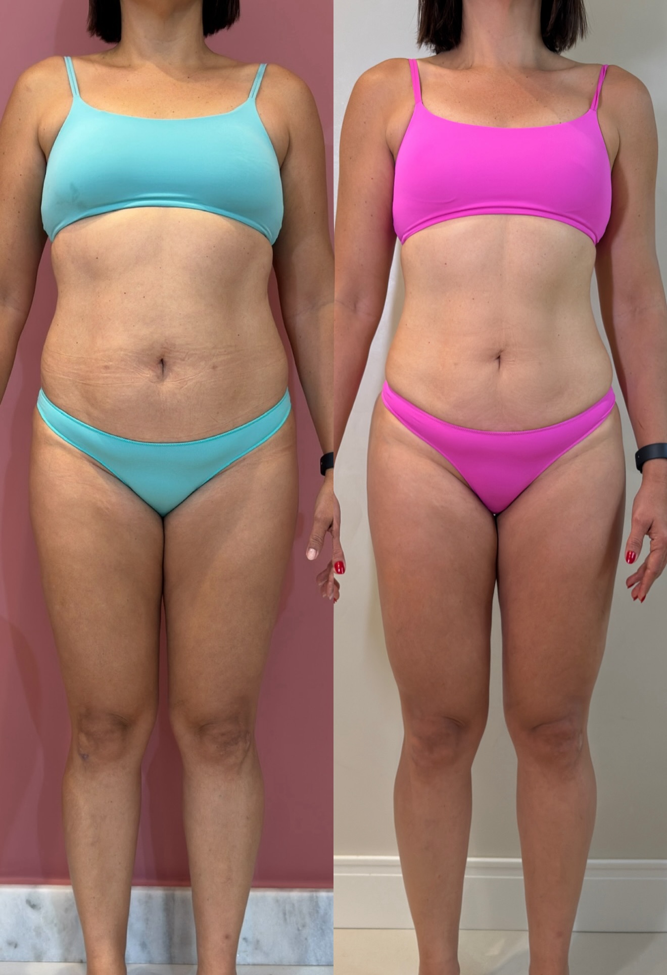 Antes da transformação