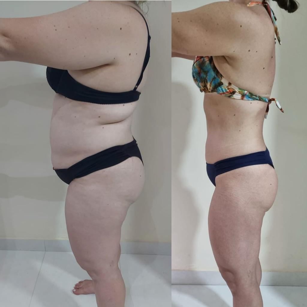 Depois da transformação