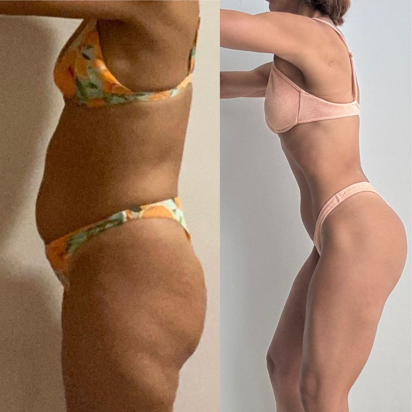 Antes da transformação